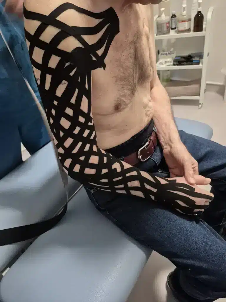 Benzi kinesio negre aplicate pe umăr, braț și spate – Clinica Kinetoterapia Piatra-Neamț